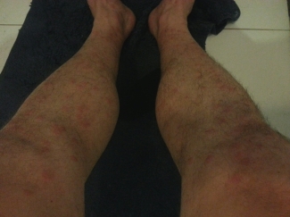 Er waren wel wat prikbeestjes gisteren... 